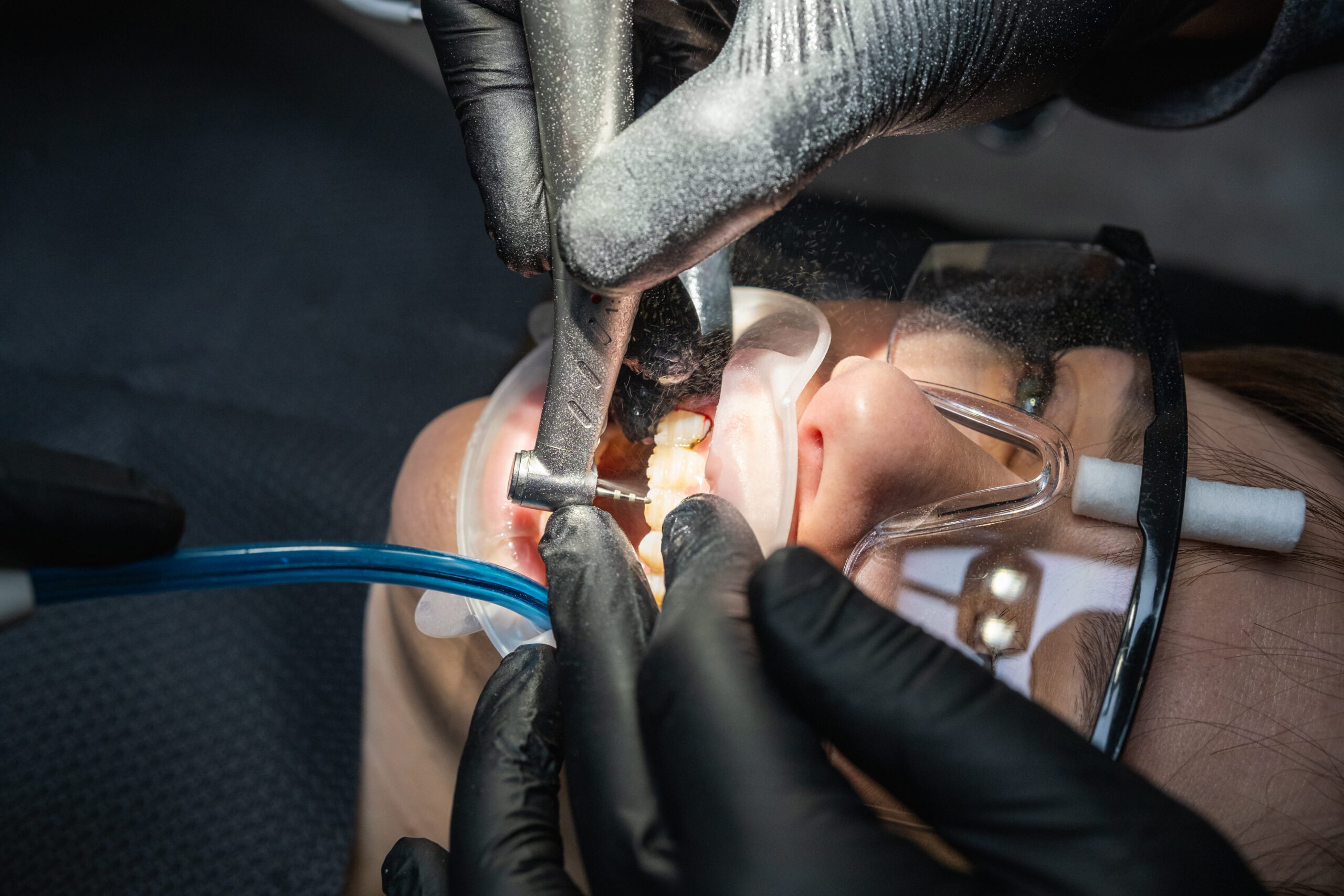 Dental repairs in Wilkesboro, NC